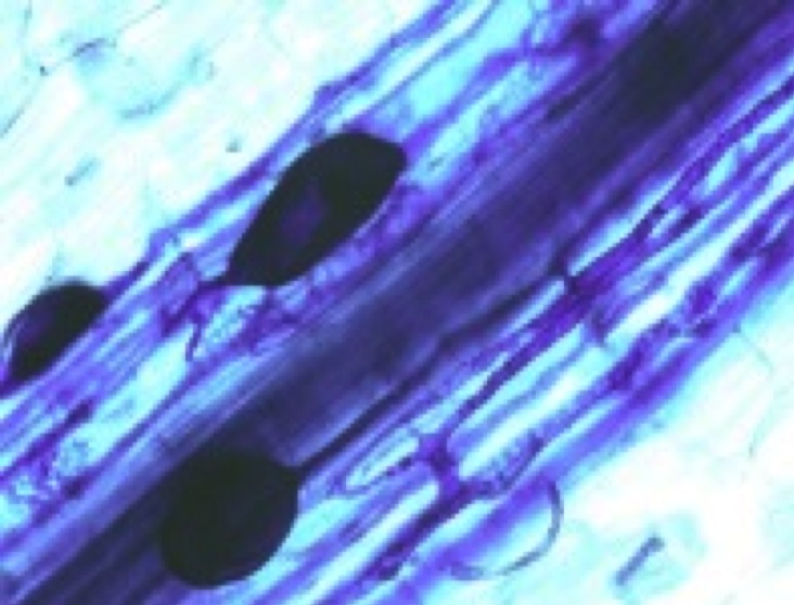 Microbial Control on Nutrient Cycling and Ecosystem